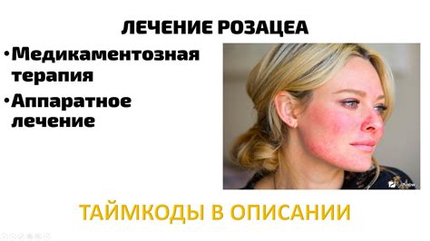 розацеа лечение - YouTube