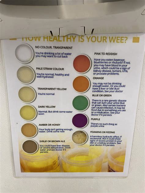 2 best u/fozzie41 images on Pholder | This poster showing how healthy