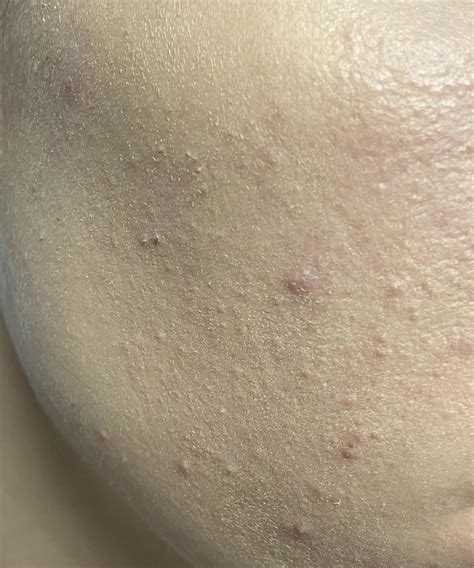 tower 28 skin tint : r/MakeupAddiction
