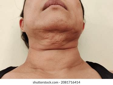6,341 Ugly neck Images, Stock Photos & Vectors | Shutterstock