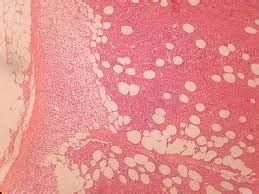 TEJIDO HEMATOPOYETICO | TEJIDOS ANIMALES