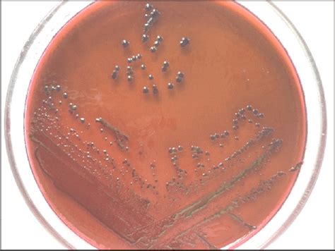 E. coli strain on Levine agar (up) and its biochemical activity on API ...