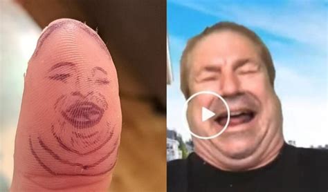 The Mysterious Case Of The Guy Who Looks Like A Thumb Uncovering The Bizarre Appearance Of A Local Resident