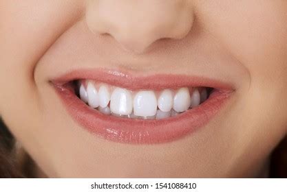 White Teeth Beautiful Smile Woman Whitening Stock Photo 1541088410 ...