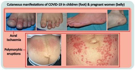 Cosmetics | Free Full-Text | The Pandemic and Your Skin—Direct and ...