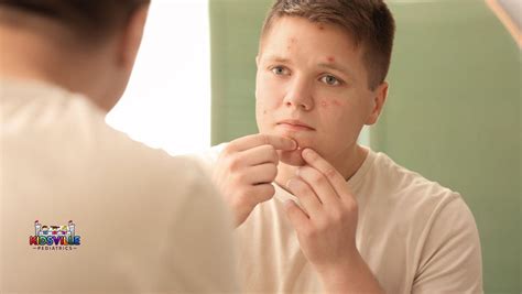 combating adolescent acne essential tips  clearer healthier skin