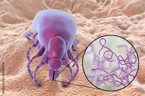 Lyme disease bacteria, Borrelia burgdorferi, transmitted by Ixodes tick ...
