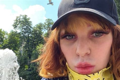 Жанна Агузарова вернула прежнюю внешность при помощи пластики - 24СМИ