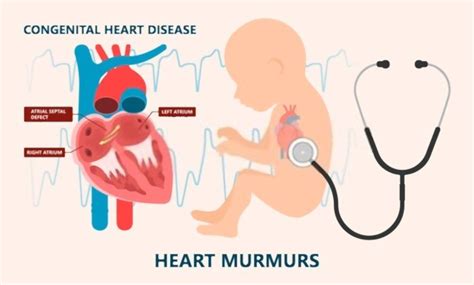 Common birth Defects and Their Symptoms - BeYAH Fitness