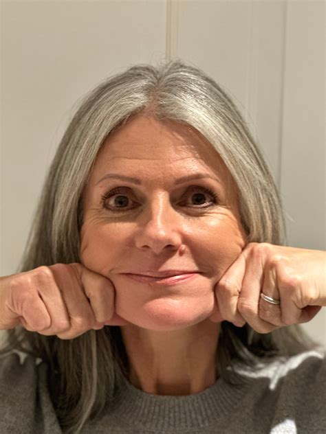 pitcher hit in face 4