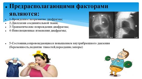 Диафрагмальные грыжи - презентация онлайн