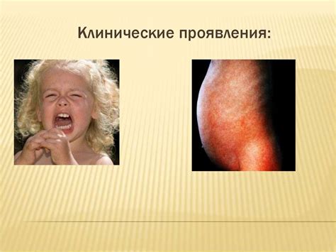 Синдром мальабсорбции - презентация онлайн