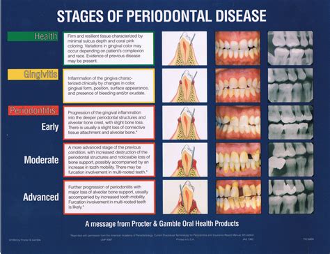 periodontal disease    affects  health victor valley news