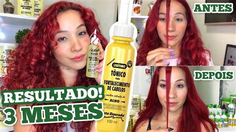 Tonico Gota Dourada Antes E Depois