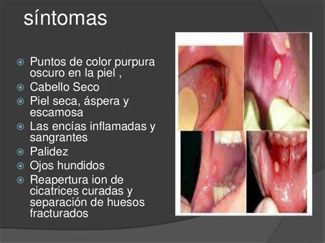 Enfermedades bucales