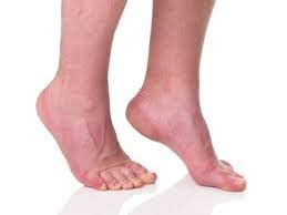 ankle equinus dubai podiatry centre