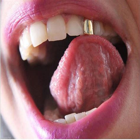 Silver Canine Teeth | canoeracing.org.uk
