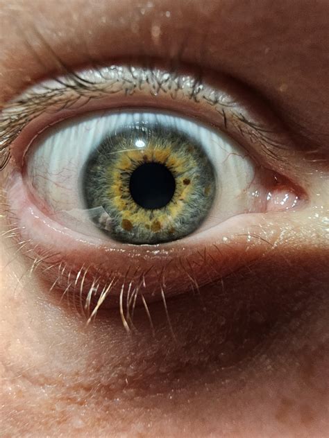 Always thought the specks were kind of cool. : r/eyes