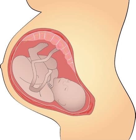 Umbilical Cord Diagram
