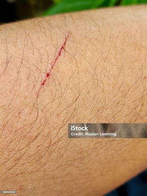 cut   arm stock photo  image  adult