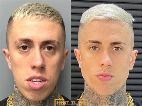 Mc Daniel revela harmonização facial: 'Estou mais bonito, mas prefiro ...