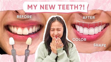 perfect teeth treatment  korea