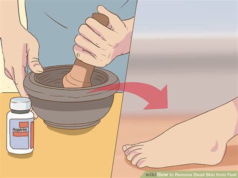 how to remove dead skin off feet at home