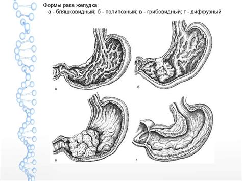 Патология желудка - презентация онлайн