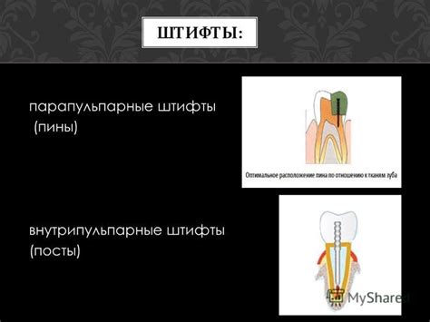 Презентация на тему: "Пины и Посты. Классификация, техника ...