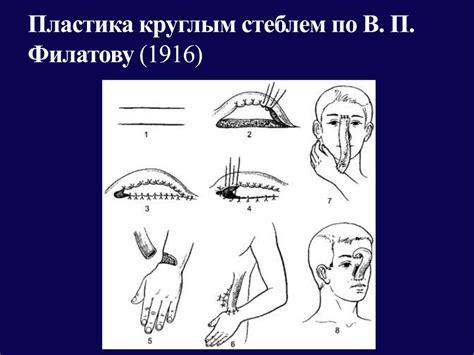 Способы восстановления дефектов кожи - online presentation