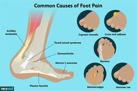 reasons  feet hurt    find relief