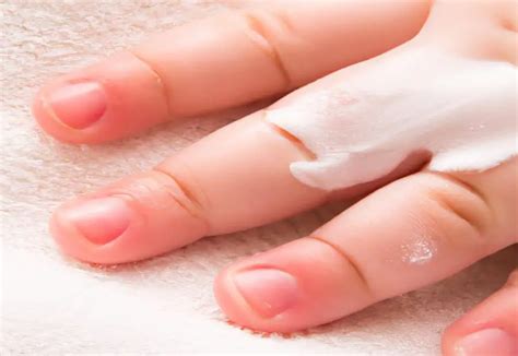 How to remove desitin from skin - PostureInfoHub