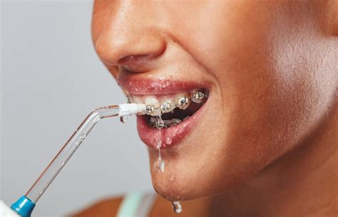 start   water flosser trivandrum dental