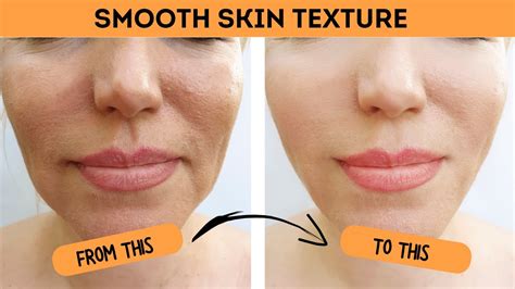 Smooth Skin Texture on Face With 3 Easy Hacks From An Esthetician - YouTube 