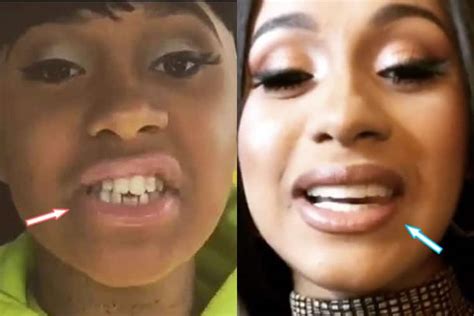 Cardi B Plastic Surgery REVEALED! (Before & After Photos 2021)