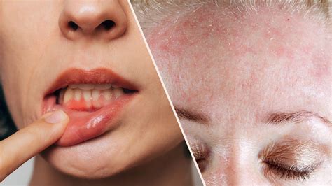 Vitamin C Deficiency? Science Explains What Happens to Your Body
