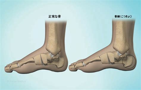 health condition symptoms  treatment