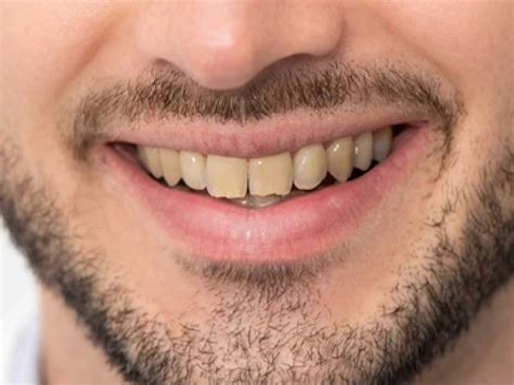 #1 Dental Gallery Success Stories: Before and After Photos