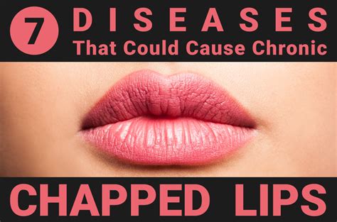 diseases    chronic chapped lips cheilitis