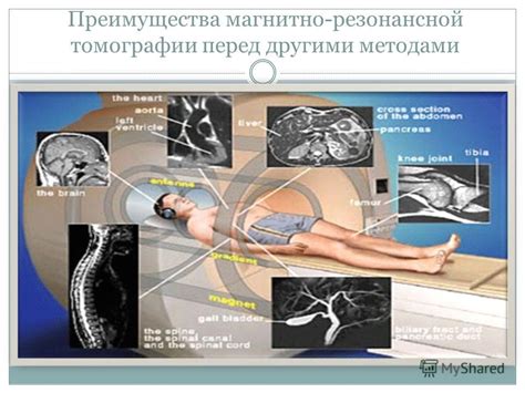Презентация на тему: "ПОДГОТОВИЛА: СТЕПАНЕНКО ВИКТОРИЯ У Ядерный ...