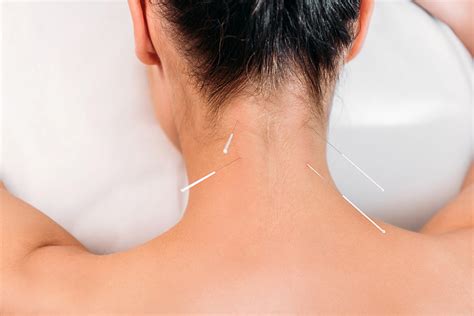 Get Pain Relief by Dry Needling - Best Massage Melbourne CBD