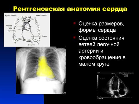 Сердце. Нормальная анатомия сердца - презентация онлайн