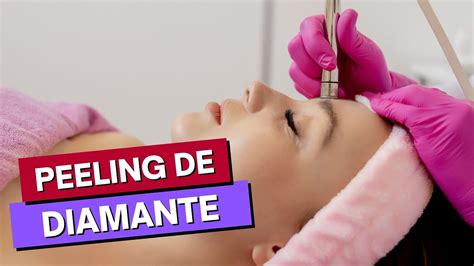 Peeling De Diamante E Perigoso