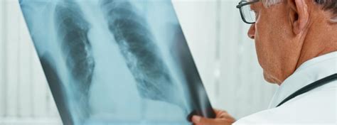 Tuberculosis | Центр громадського здоров’я