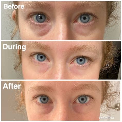 Hydrogel Eye Patches | Mary kay, Mary kay marketing, Beauty consultant