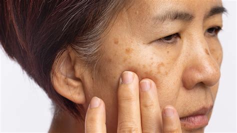10 common skin conditions