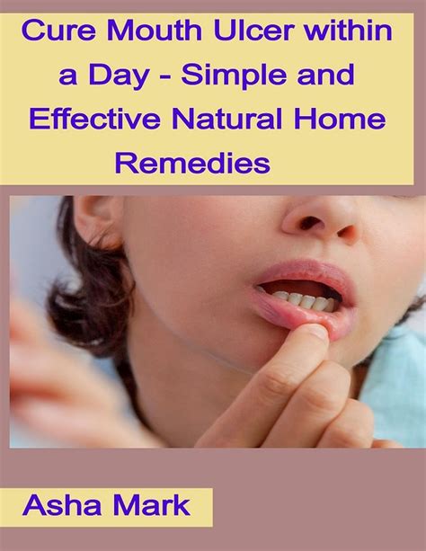 Natural Remedies For Stomach Ulcer 5