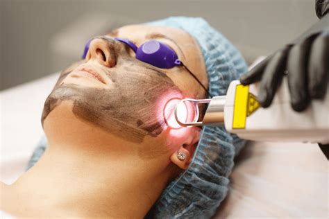 Remoção De Manchas A Laser Preço