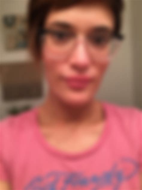 Inflamed lips. Has anyone else experienced this? : r/eczema