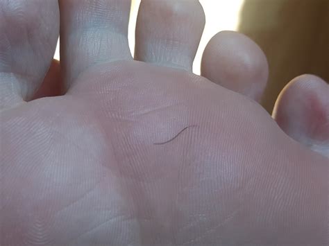 I stepped on this hair and it embedded like a splinter. : r ...